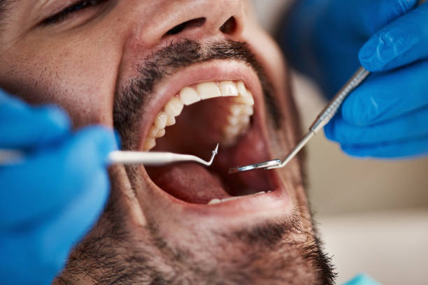 Best Pediatric Emergency Dentist in Greenwood, LA